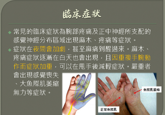 惱人的滑鼠手 腕隧道症候群 Coolanews府城電子報 Pchome 個人新聞台